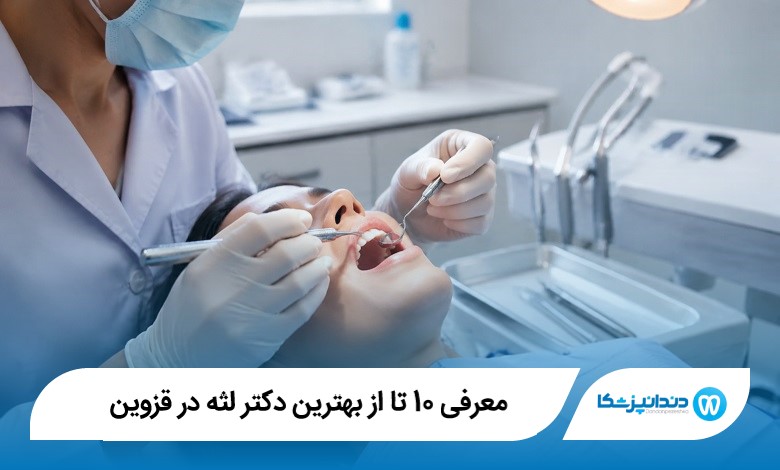 معرفی 10 تا از بهترین دکتر لثه در قزوین