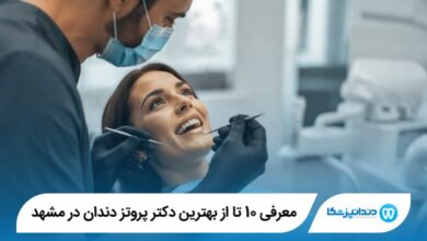 معرفی 10 تا از بهترین دکتر پروتز دندان در مشهد