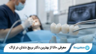 بهترین دکتر بریج دندان در اراک