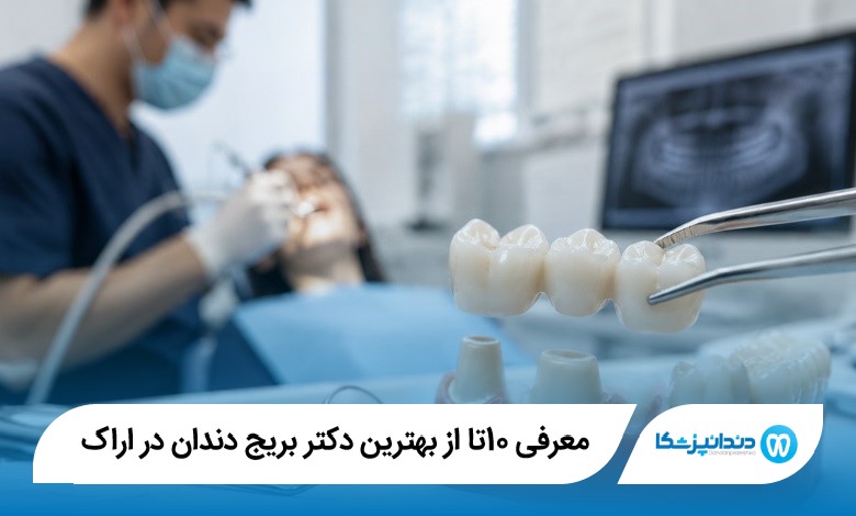 بهترین دکتر بریج دندان در اراک