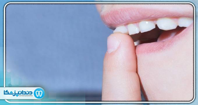 آیا دندان لق سفت می شود؟