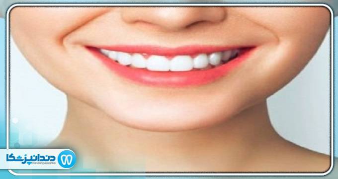 آیا می توان بدون جراحی مشکل دندانی فک را حل کرد؟