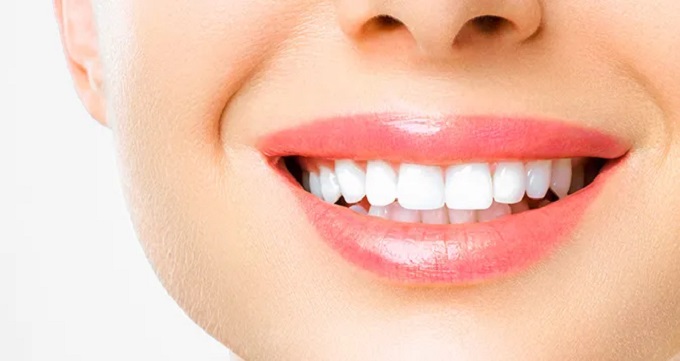 توصیه های بعد از انجام بلیچینگ دندان