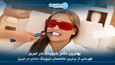 بهترین دکتر بلیچینگ در تبریز