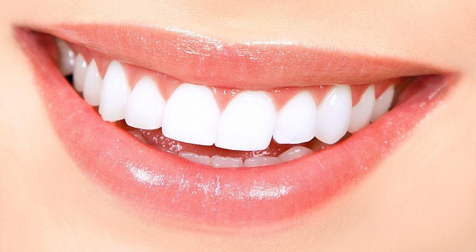 بلیچینگ دندان چیست و چگونه انجام می شود؟