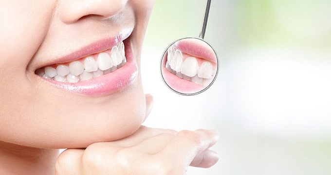 مزایا و معایب انجام بلیچینگ دندان