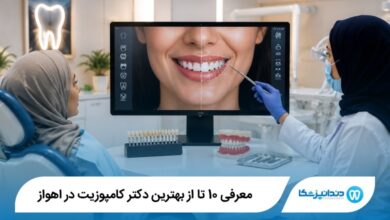 بهترین دکتر کامپوزیت در اهواز