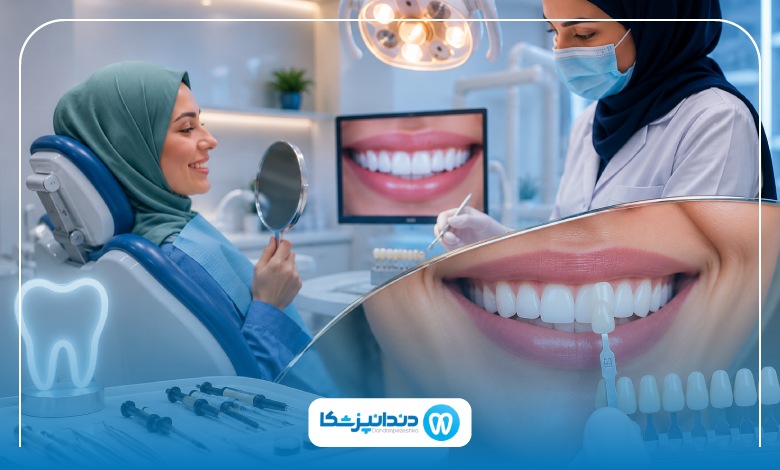 بهترین برندهای کامپوزیت در اهواز کدامند؟