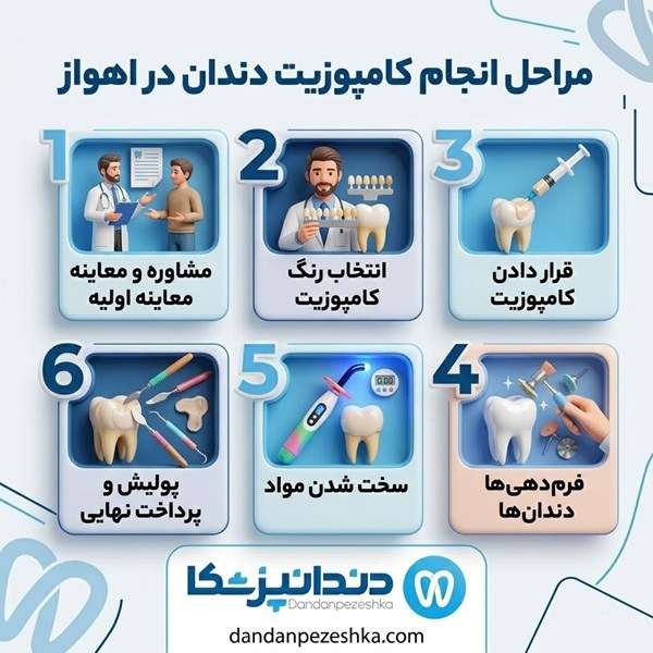 مراحل انجام کامپوزیت دندان در اهواز