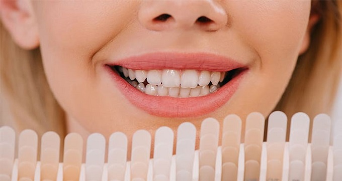 کامپوزیت دندان چیست و چه کاربردی دارد؟