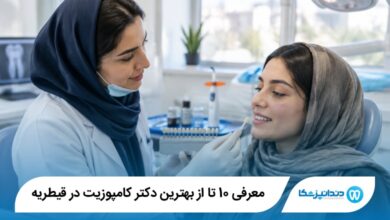بهترین دکتر کامپوزیت در قیطریه