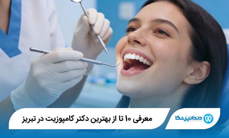 بهترین دکتر کامپوزیت در تبریز