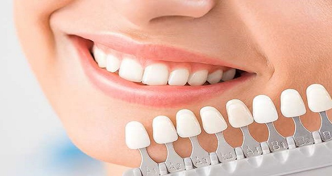 دندانپزشک زیبایی و ترمیمی چه خدماتی ارائه می دهد؟
