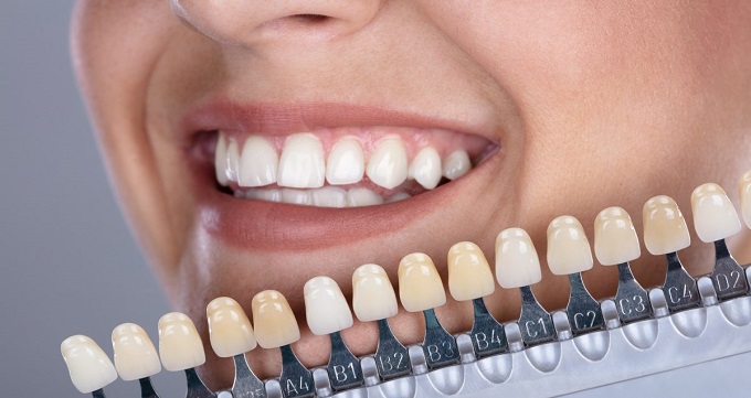 معیارهای انتخاب بهترین دندانپزشک زیبایی و ترمیمی در تجریش