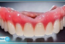 بهترین دکتر پروتز دندانی در تبریز