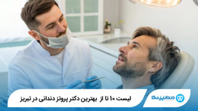 بهترین دکتر پروتز دندانی در تبریز