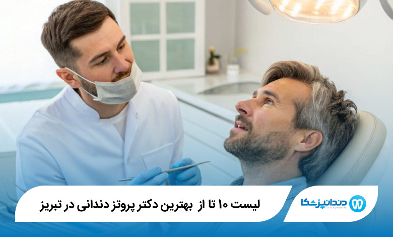 بهترین دکتر پروتز دندانی در تبریز