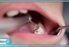 بهترین جراح دندانپزشک در تبریز