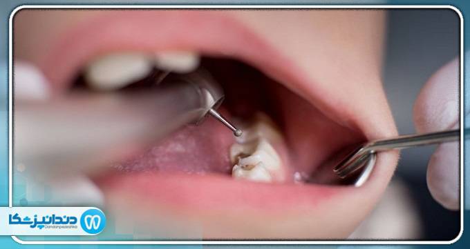 بهترین جراح دندانپزشک در تبریز