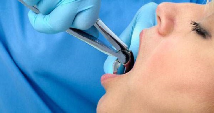 توصیه های بهترین جراح دندانپزشک در تبریز
