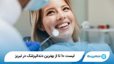 بهترین دندانپزشک در تبریز