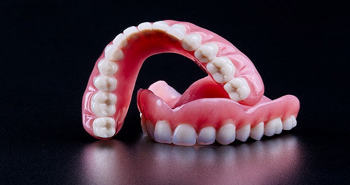 پروتز دندان چیست و چه تفاوتی با ایمپلنت دارد؟
