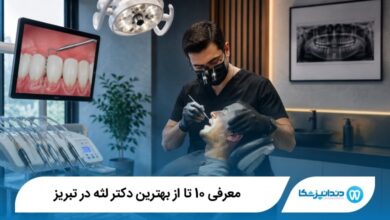 بهترین دکتر لثه در تبریز