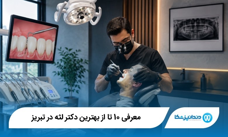 بهترین دکتر لثه در تبریز