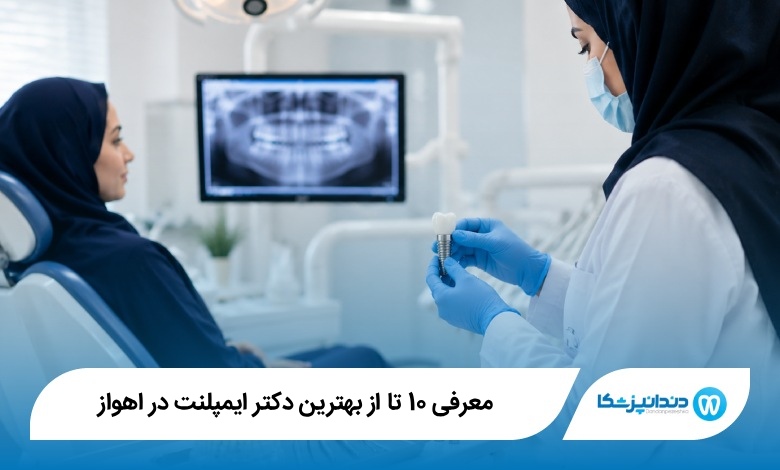 بهترین دکتر ایمپلنت در اهواز