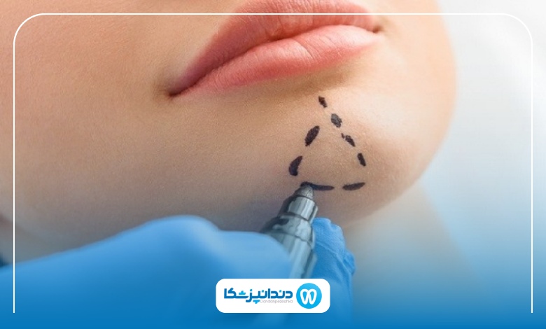 بهترین دکتر پروتز فک