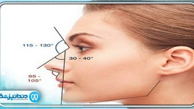 بهترین دکتر پروتز فک در قیطریه