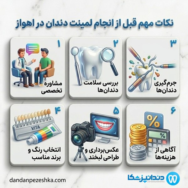 نکات مهم قبل از انجام لمینت دندان در اهواز