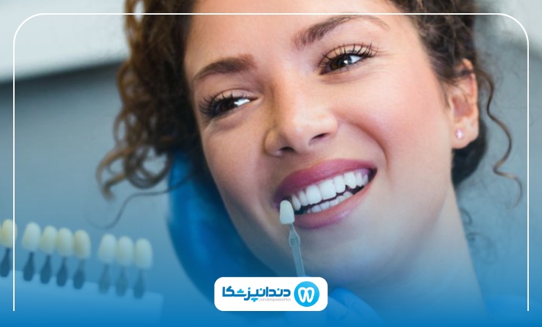 بهترین متخصص لمینت در اهواز