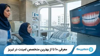 بهترین متخصص لمینت در تبریز