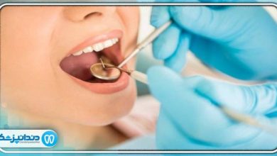 توصیه های بعد از انجام عصب کشی دندان