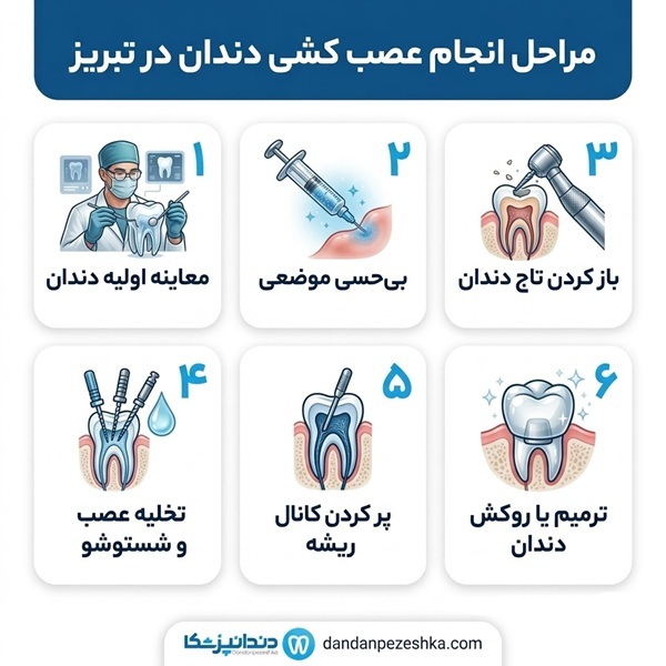 مراحل انجام عصب کشی دندان در تبریز