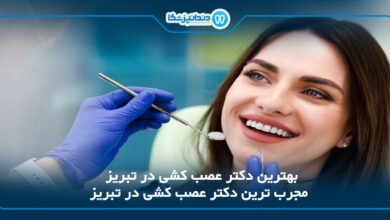 بهترین دکتر عصب کشی در تبریز