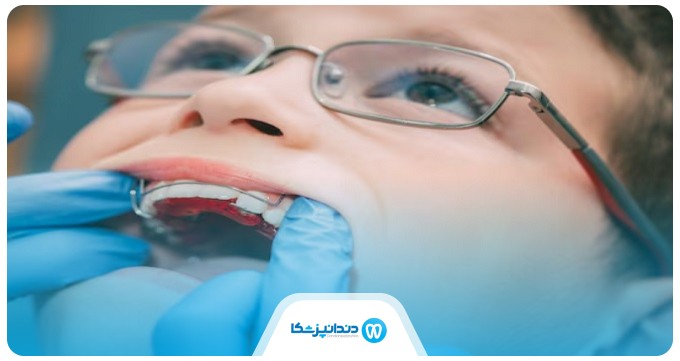 مزایا انجام ارتودنسی دندان