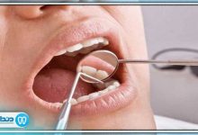 بهترین دندانپزشک درمان ریشه در قیطریه