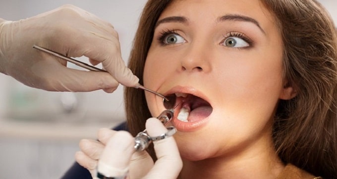 روش های درمان بهترین دندانپزشک درمان ریشه 