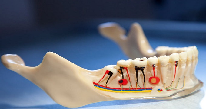 علل عفونت و آسیب ریشه دندان چیست؟