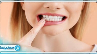 راه های درمان و پیشگیری عفونت دندان