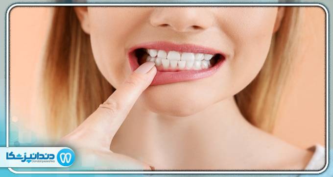 راه های درمان و پیشگیری عفونت دندان