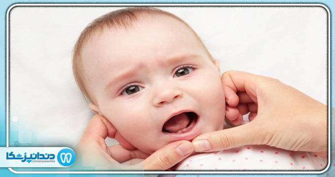 علائم دندان درآوردن در نوزادان چیست؟