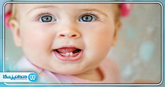 راه های پیشگیری از خراب شدن دندان شیری کودکان