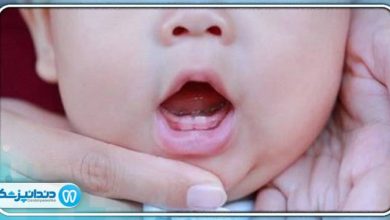 سن مناسب برای دندان درآوردن نوزادان چه زمانی است؟