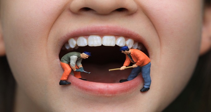 عصب کشی دندان چیست و چگونه انجام می شود؟