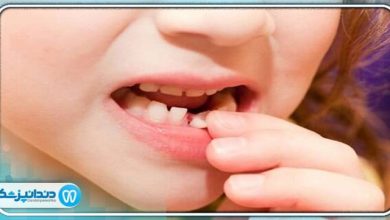 چگونه بفهمیم دندان شیری است یا دائمی