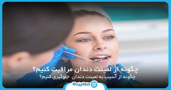 چگونه از لمینت دندان مراقبت کنیم؟