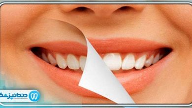 آیا جوش شیرین دندان ها را سفید می کند؟
